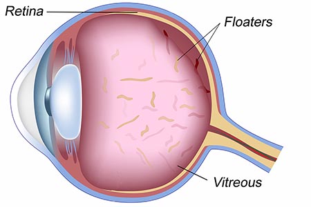 نمای داخلی چشم