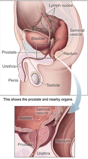 علائم و درمان حجیم شدن پروستات (BHP)