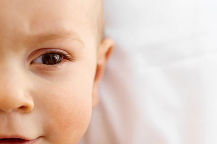 هر آنچه که باید راجع به اگزمای پوستی در نوزادان بدانید