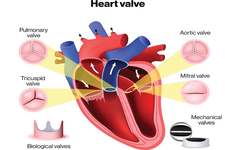 نارسایی دریچه میترال قلب چیست