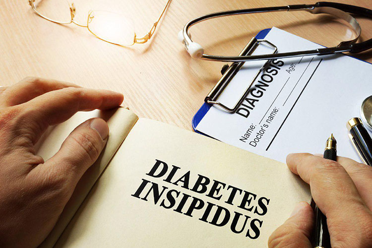 آشنایی با دیابت بی‌مزه و ارتباط آن با تشنگی شدید و دفع ادرار زیاد در افراد