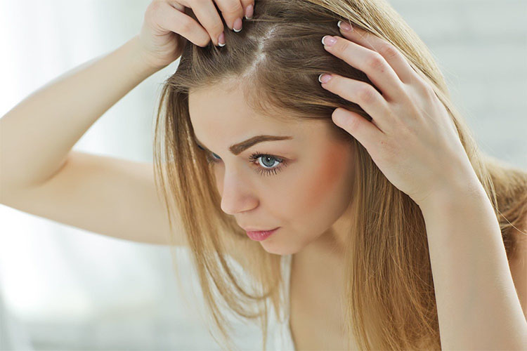 علت ریزش مو و طاسی در زنان چیست و چطور باید شیوع آلوپسی آندروژنتیک را درمان کرد؟
