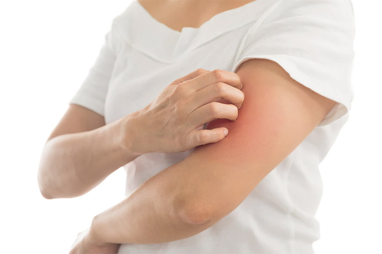 مهم‌ترین علل خارش پوست چیست و چگونه باید آن‌ها را درمان کرد؟