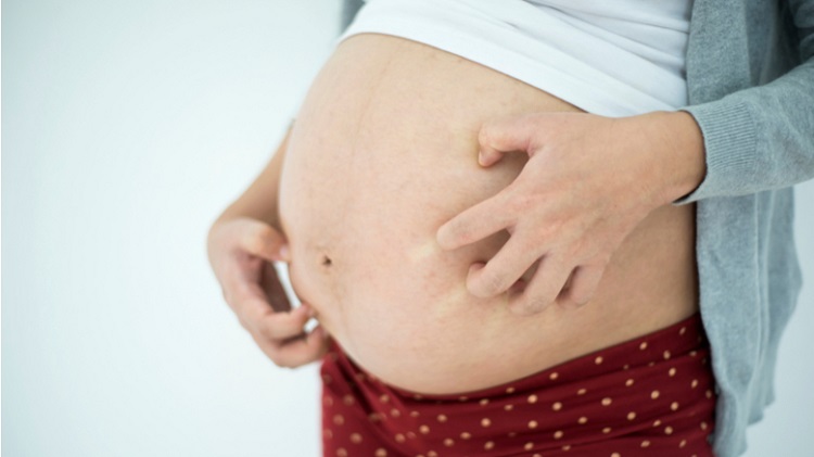 کلستاز بارداری چیست؟