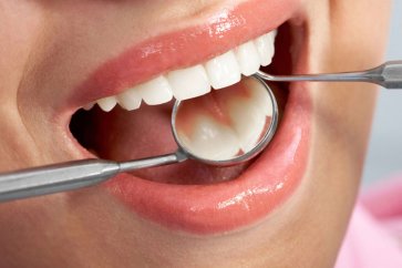 روش‌های کلیدی و مهم برای سالم نگه داشتن دهان و لثه
