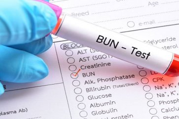 هر آنچه که باید در مورد آزمایش BUN بدانید.
