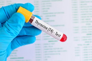 در مورد آزمایش T4 یا تیروکسین چه می دانید؟
