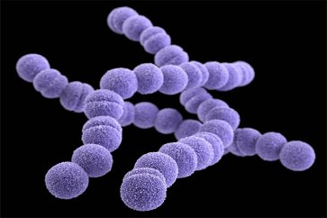 بررسی باکتری استرپتوکوکوس و ارتباط آن با عفونت‌های گلو