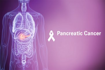 سرطان پانکراس یا لوزالمعده چیست و چطور باید آن را درمان کرد؟