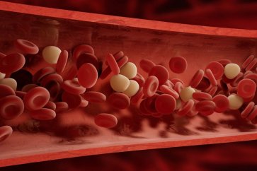 کم خونی همولیتیک چیست و چگونه می‌توان آن را درمان کرد؟