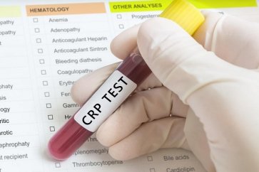 آزمایش پروتئین فاز حاد یا تست CRP چیست و چه زمانی انجام می‌شود؟