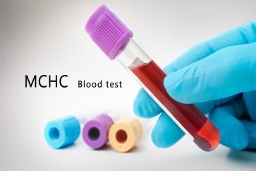MCHC در برگه آزمایش خون نشانه  چیست؟