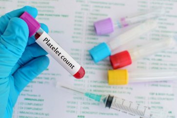 آزمایش پلاکت خون یا Plt چه زمانی درخواست می‌شود؟